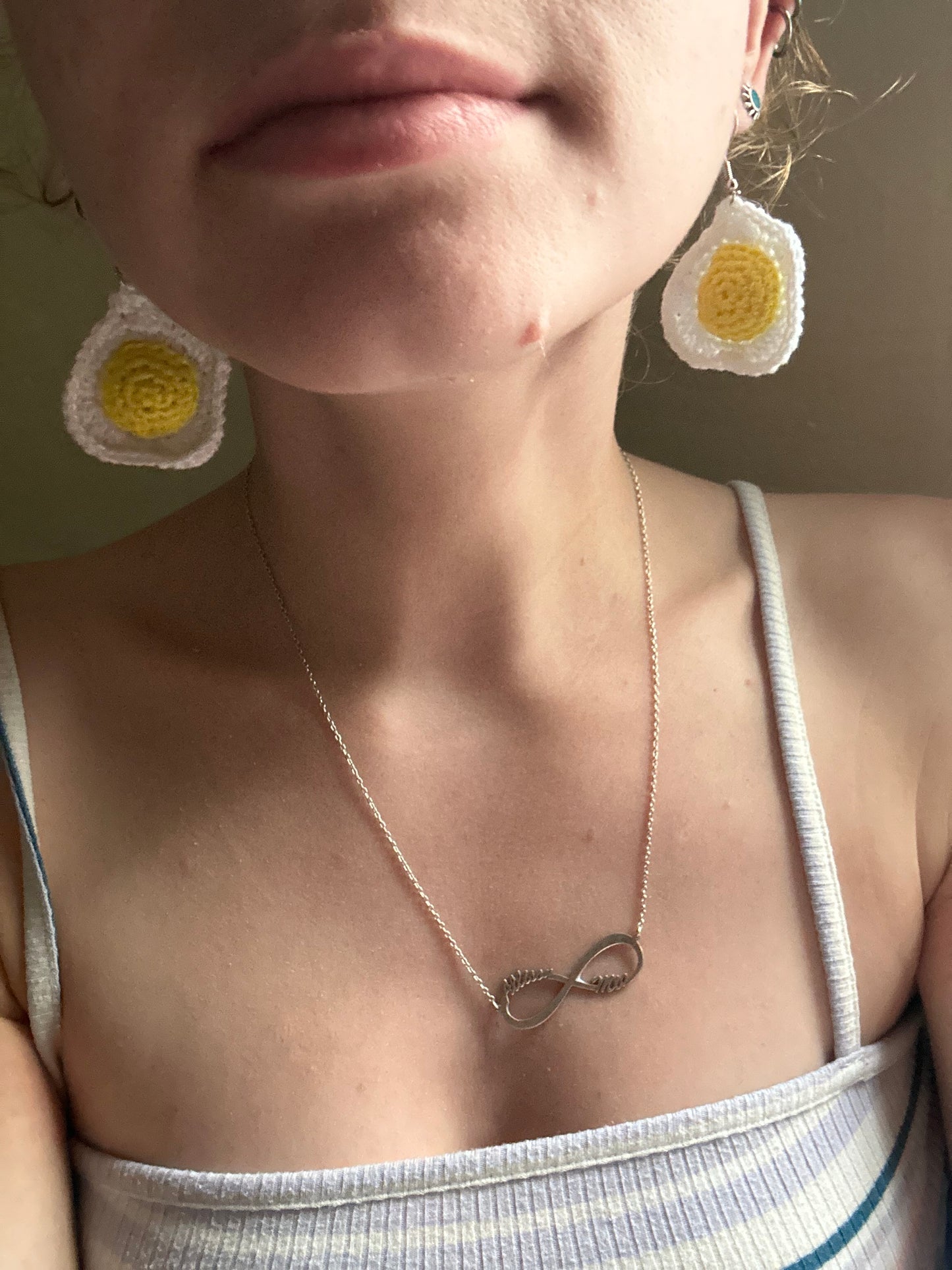 Fried Egg Earrings